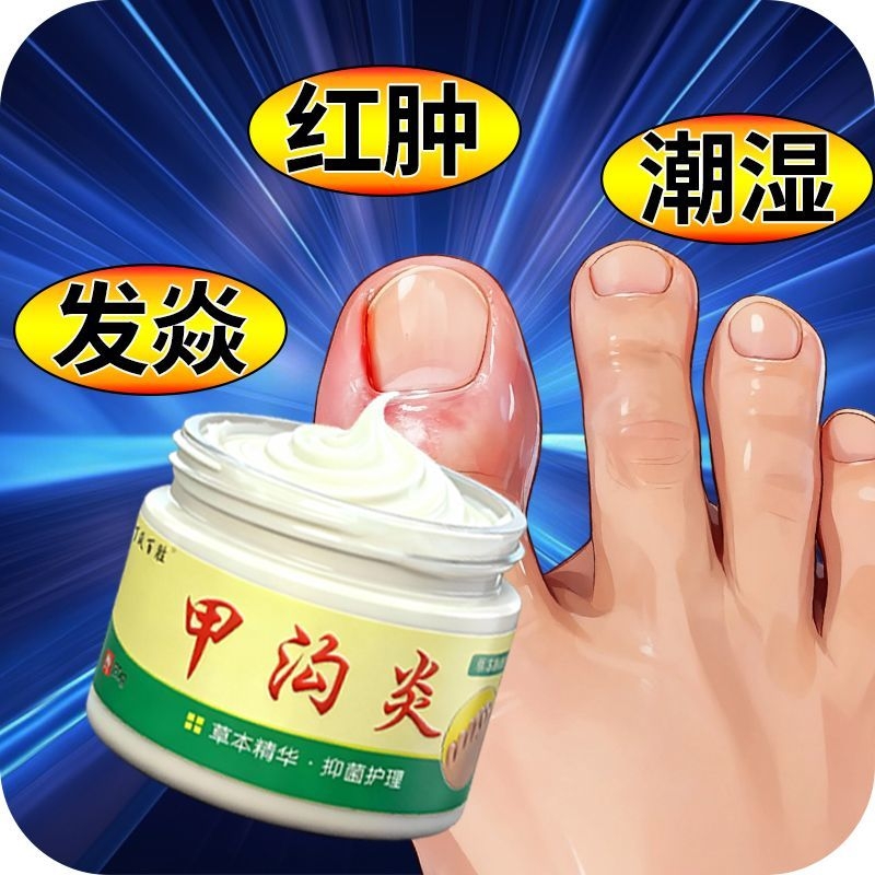 甲沟焱脚指甲疼大拇指往肉里长销肿感染发焱红肿化脓脚指甲止痛膏