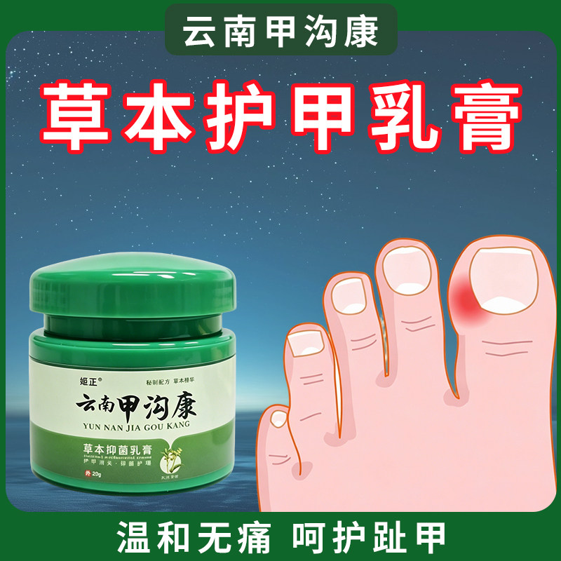 云南甲沟康修复趾指甲去息肉嵌甲甲板增厚指甲发黄空甲萎缩