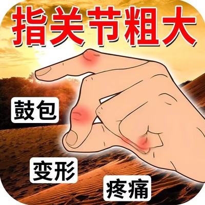 手指关节疼用关节粗大变形肿大僵硬骨性关节贴膏