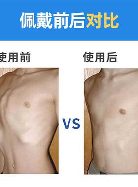 极速儿童鸡胸矫j正器漏斗胸护胸心脏开胸术后固定板小孩幼儿肋骨