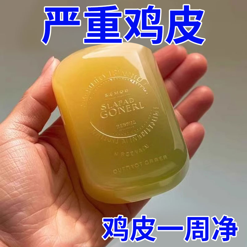 【草本皂】去全身鸡皮肤疙瘩毛囊角质腿部鱼鳞蛇皮滋润手工皂
