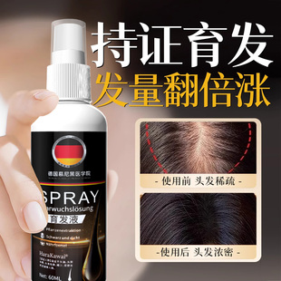 生发液快速防脱发增发密发头发增长液秃顶育发液长发剂喷雾男女士