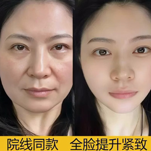 【保价双十一】提拉紧致面膜胶原蛋白抗皱淡化法令纹小V脸神器