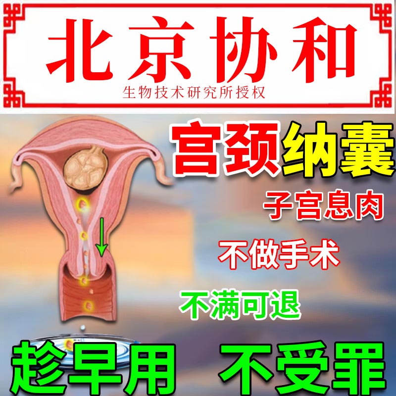 宫颈纳氏囊肿内膜息肉宫颈肥大糜烂修复子宫治疗宫颈囊肿的药CJ