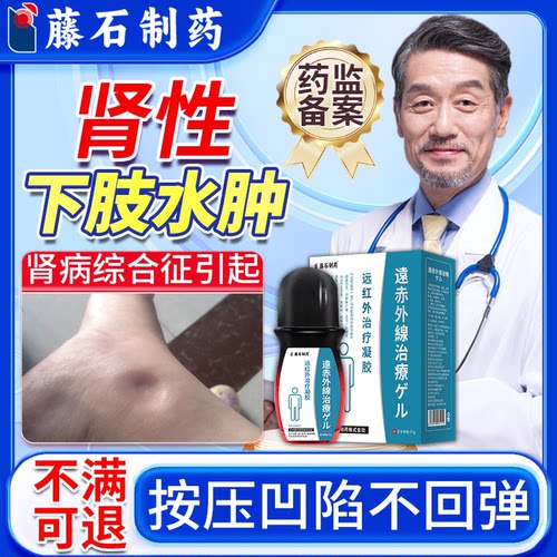 肾病综合征肾性下肢水肿按压凹陷有坑