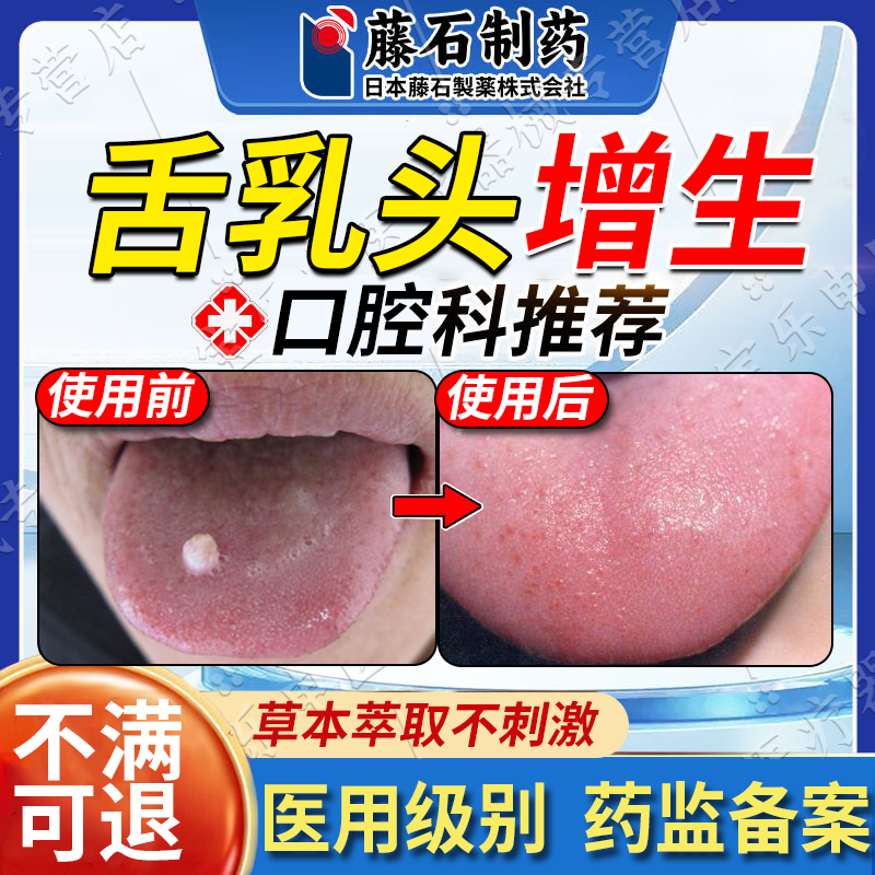 舌根乳头增生舌立康灵舌炎喷雾舌头舌乳头炎溃疡起肉球疙瘩疼vp