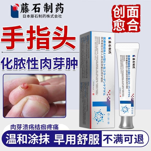 【手指化脓性肉芽肿】手指肉芽溃烂结痂疼痛药房同款可搭配药膏vp