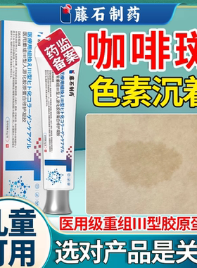 儿童去牛奶咖啡斑胎记去除神经性纤维瘤药监备案软膏激光防晒贴VP