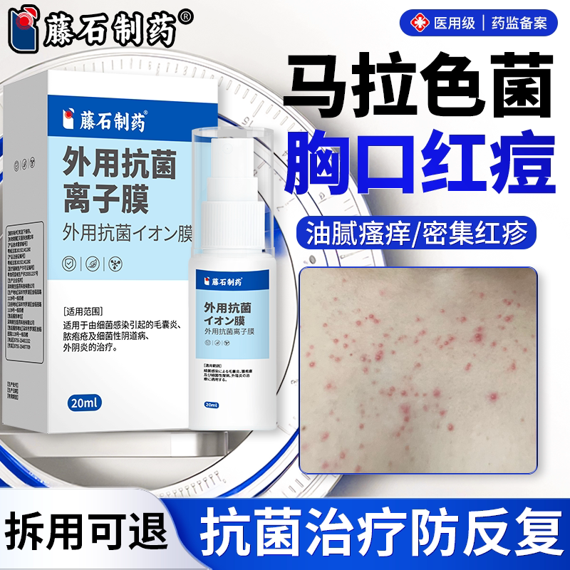 背后长痘痘后背毛囊炎去除背上痘痘马拉色菌毛囊炎藤石制药喷剂VP