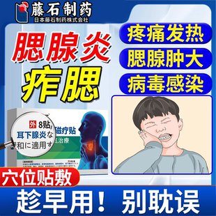 儿童成人腮腺炎膏药监备案贴腮腺淋巴结肿大痄腮吃什么散结胀痛VP