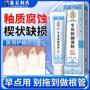 牙齿楔状缺损修补可搭牙釉质腐蚀牙膏蛀牙龋齿牙龈敏感专用VP