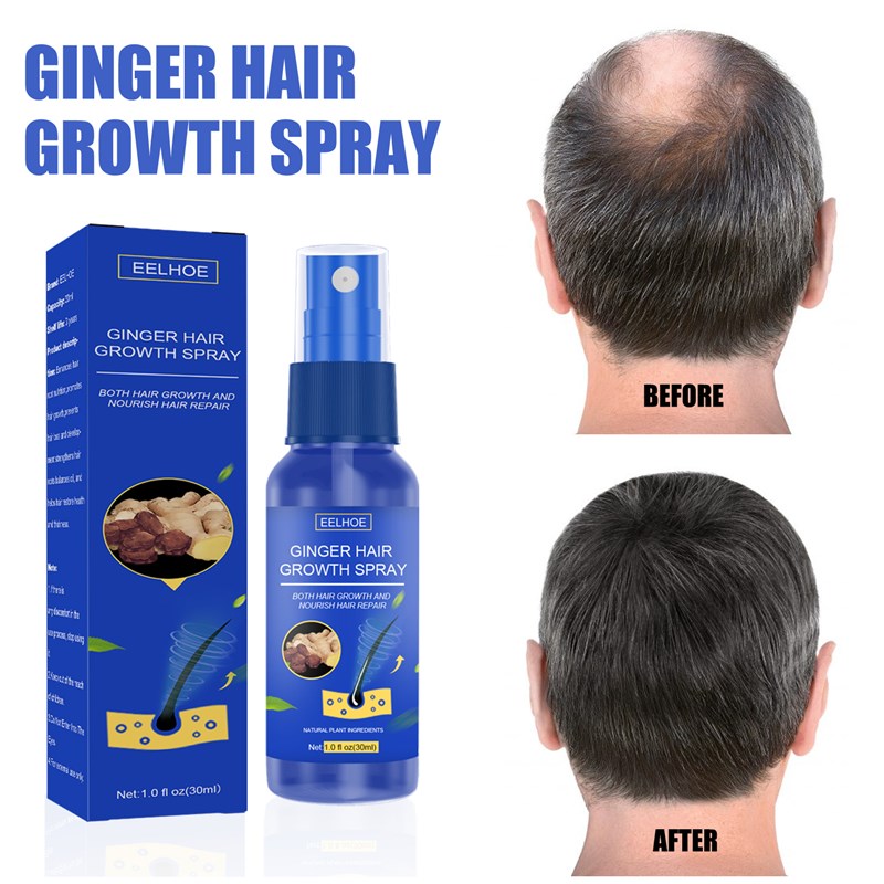 极速EEaLHOEGinger Hair Growth Serum Spray Anti Hair Loss Reg