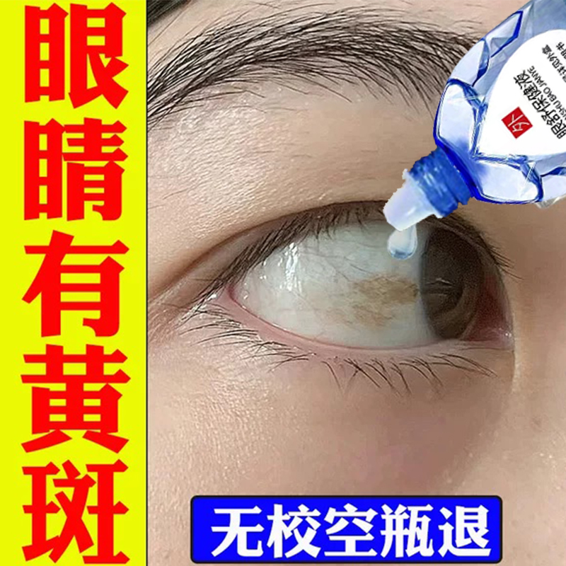 氯化钠滴眼液缓解眼部干涩症状干眼症防止眼睛干涩磨痛出现充血