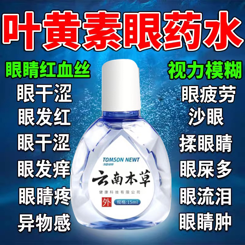 托批卡胺滴眼液蔡敏维闪亮江西仁和红小支荼敏维奈敏维眼药水缓解