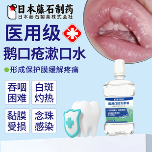 鹅口疮专用漱口水白斑可搭碳酸氢钠霉菌素片的混悬液药房同售OM