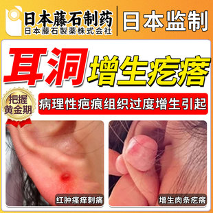 藤石制药耳洞增生疤痕疙瘩凸起去硬肉除膏凝胶软化针鼓包瘙痒OM