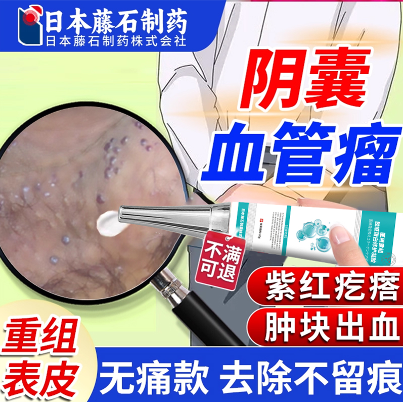 阴囊血管角化瘤紫红疙瘩肿块出血蜘蛛痣红斑表皮瘙痒按压疼HB