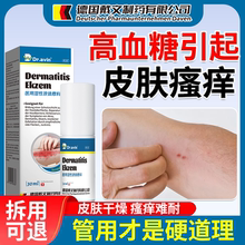 高血糖皮肤痒专用老年人止痒膏糖尿病引起皮肤瘙痒阴囊痒外阴痒K1