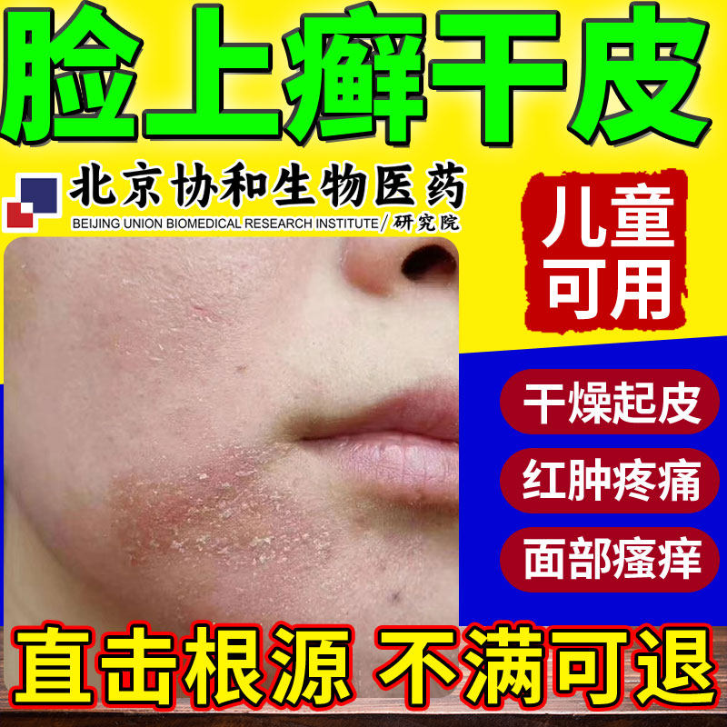 脸上起癣干皮脸颊两边小疙瘩皮肤痒干燥泛红长痘痘专用膏药贴hv