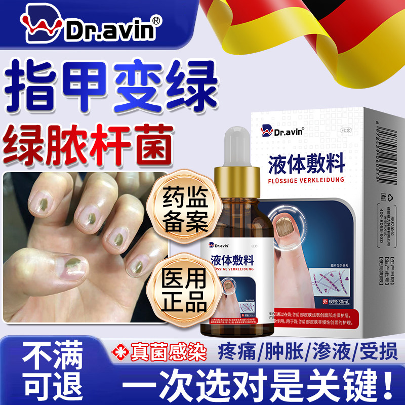 绿脓杆菌引起指甲变绿真菌感染甲癣空甲床分离化脓发霉抑菌敷料OM