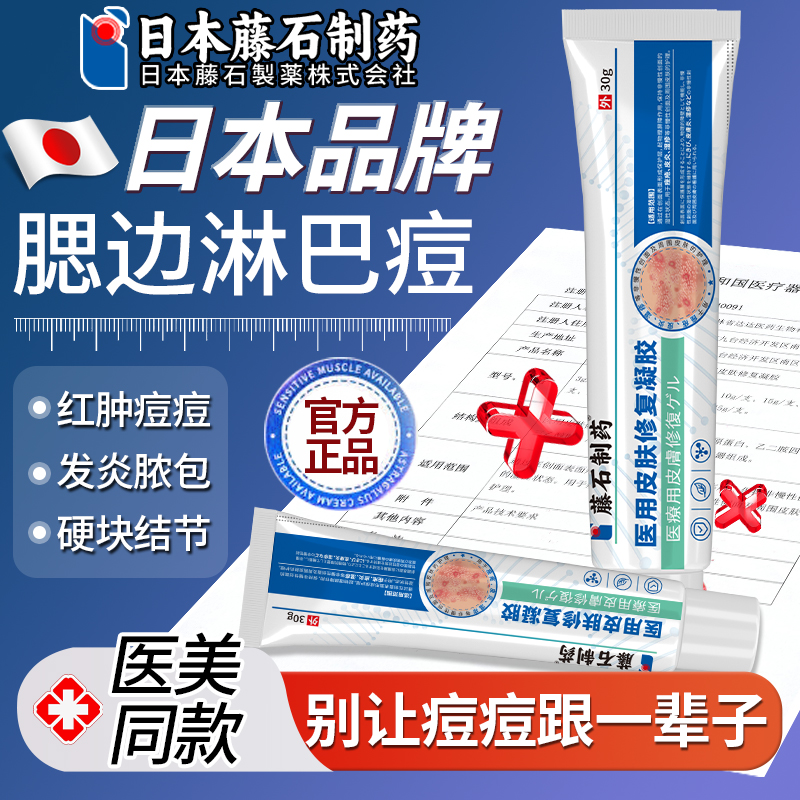 腮边脖子淋巴痘下巴反复长痘