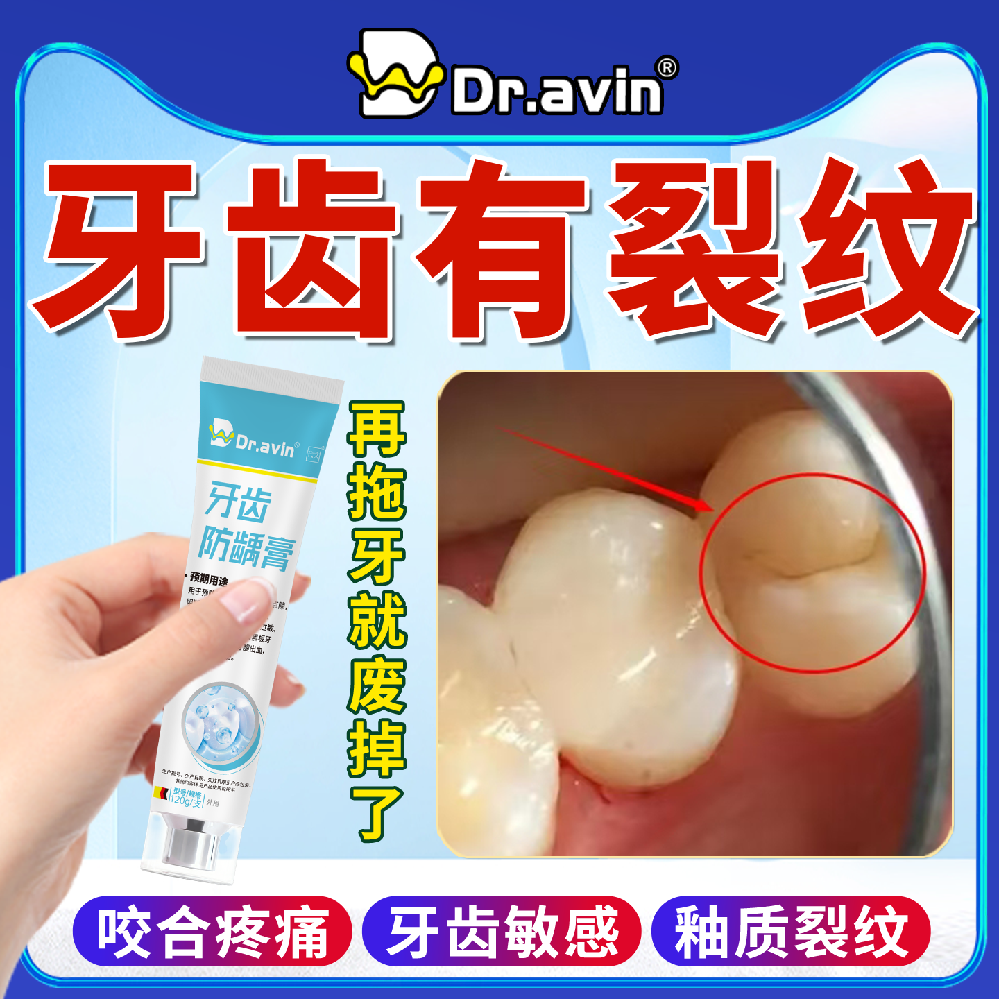 牙隐裂牙齿敏感咬合疼痛有裂纹自发性深层修蛀护牙龈含氟防龋膏FJ,医疗器械,牙齿防龋/脱敏类,淘宝优惠券,粉丝福利购,淘宝优惠卷