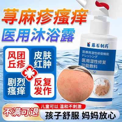 儿童急慢性寻荨麻疹过敏止痒断止痒根专用沐浴露肥皂增强免疫力OM