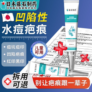 凹陷性疤痕祛疤膏生长因子陈旧水痘痘坑凹洞修复填充去凹凸儿童K1