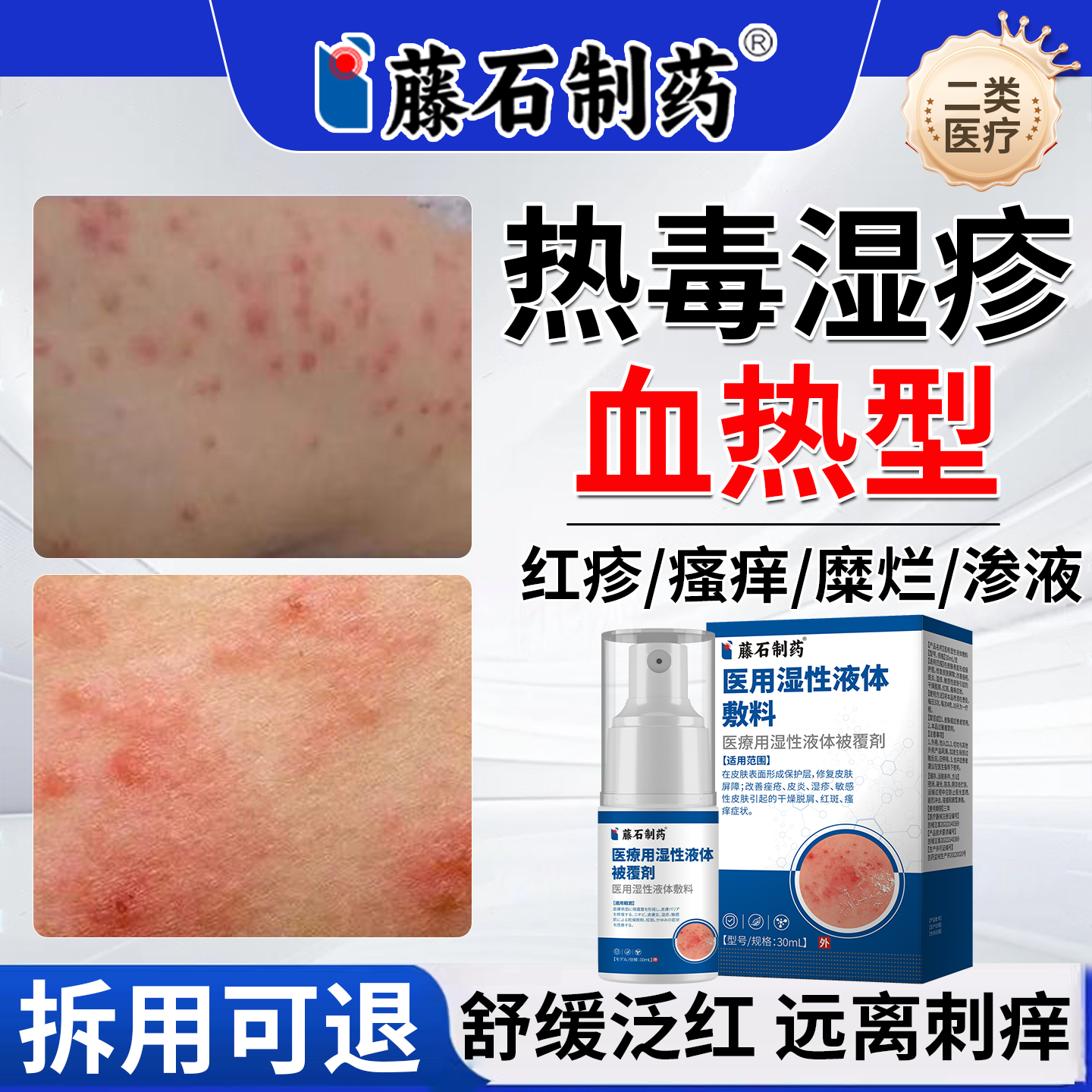热毒湿疹止痒膏血热皮肤痒癣除湿专用水泡去顽固皮炎真菌感染OM