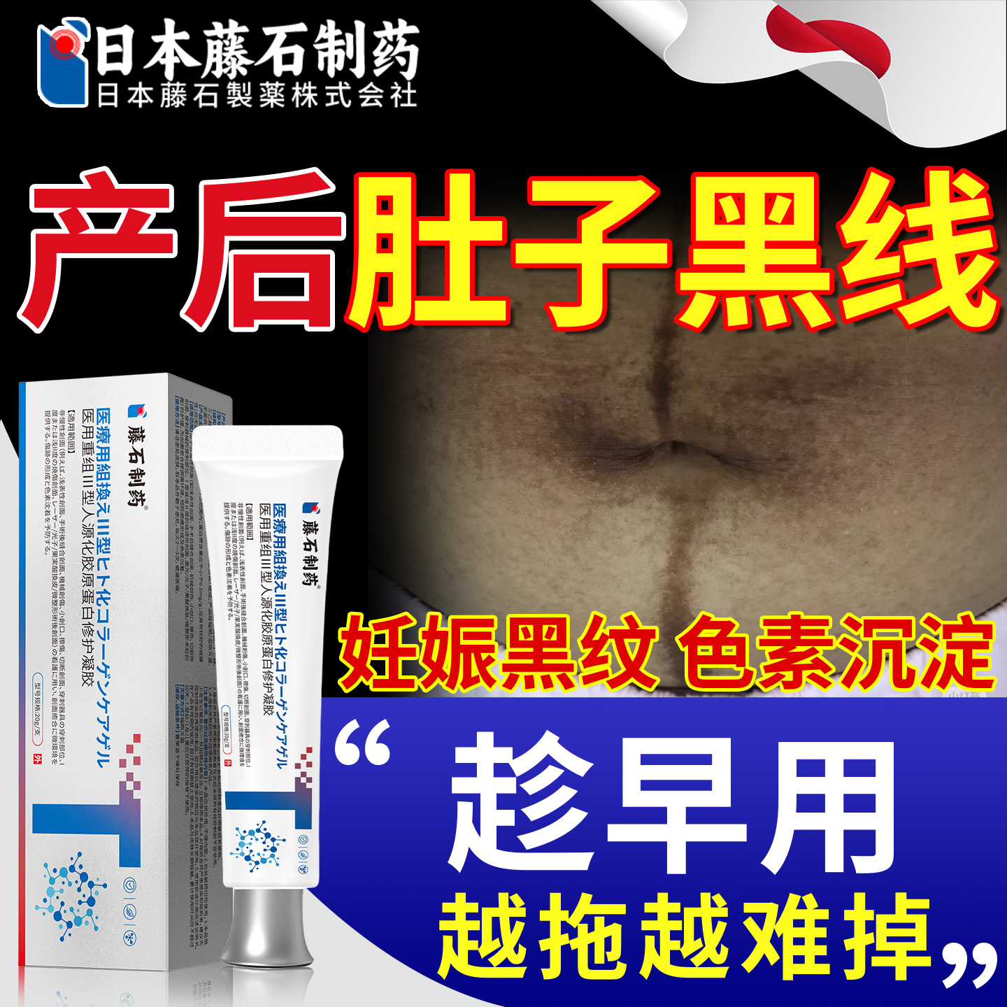 重组Ⅲ型人源化胶原蛋白修护凝胶产后肚子黑色素沉淀黑线淡化OM