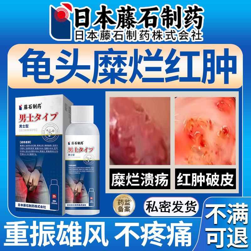 龟头溃烂糜烂红肿开裂豆腐渣白垢发炎小红点红斑包皮炎真菌感染hb