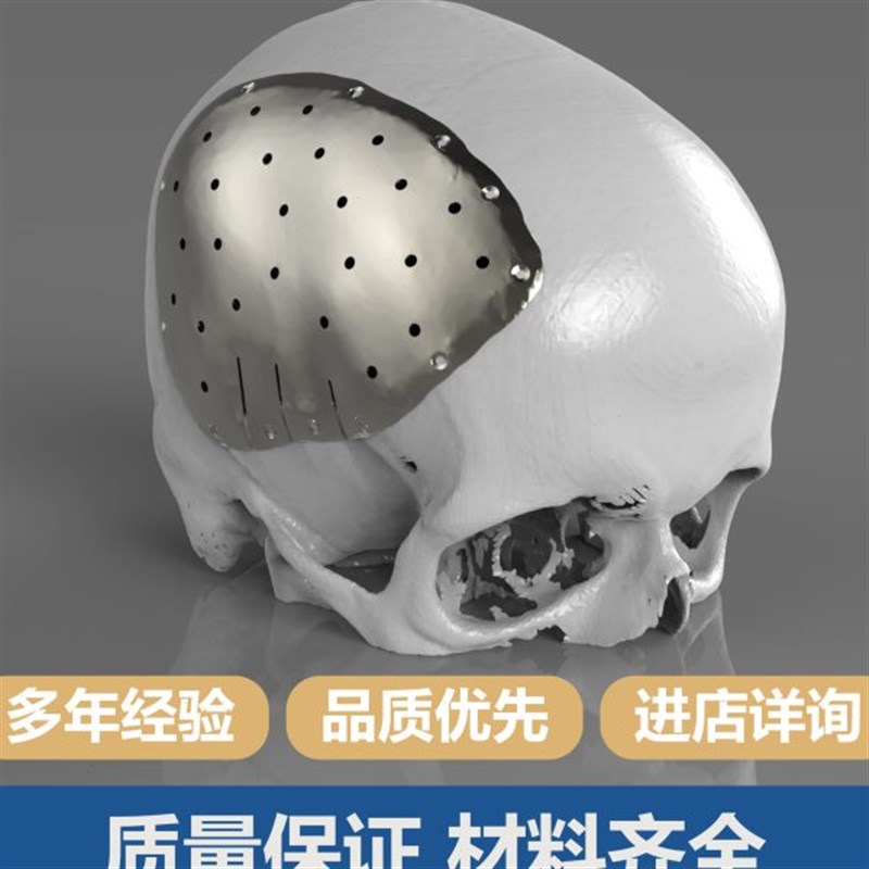 【精度金属3D打印n服务】不锈钢模具钢钛合金铝合金镍铬合金