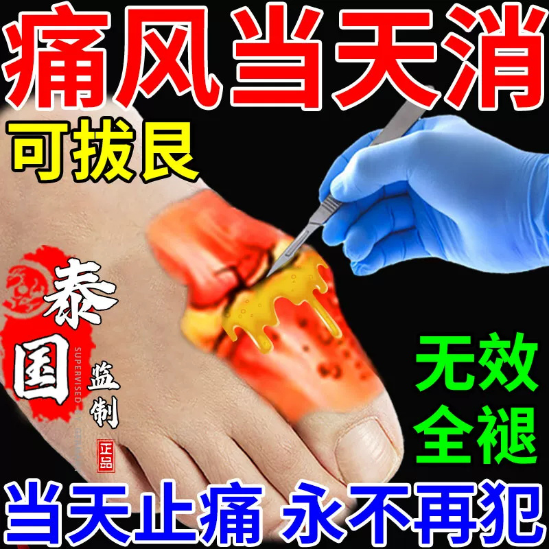 一正远红外痛消贴颈椎病肩周炎贴膏蜂毒风湿类关节痛腰疼腰椎贴