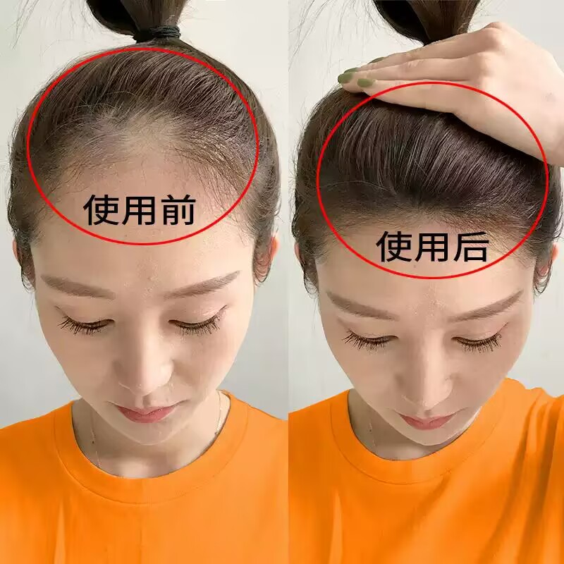 同仁堂防脱发育发液生发增发密发