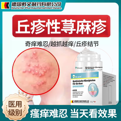 【拆用可退】丘疹性荨麻疹专用