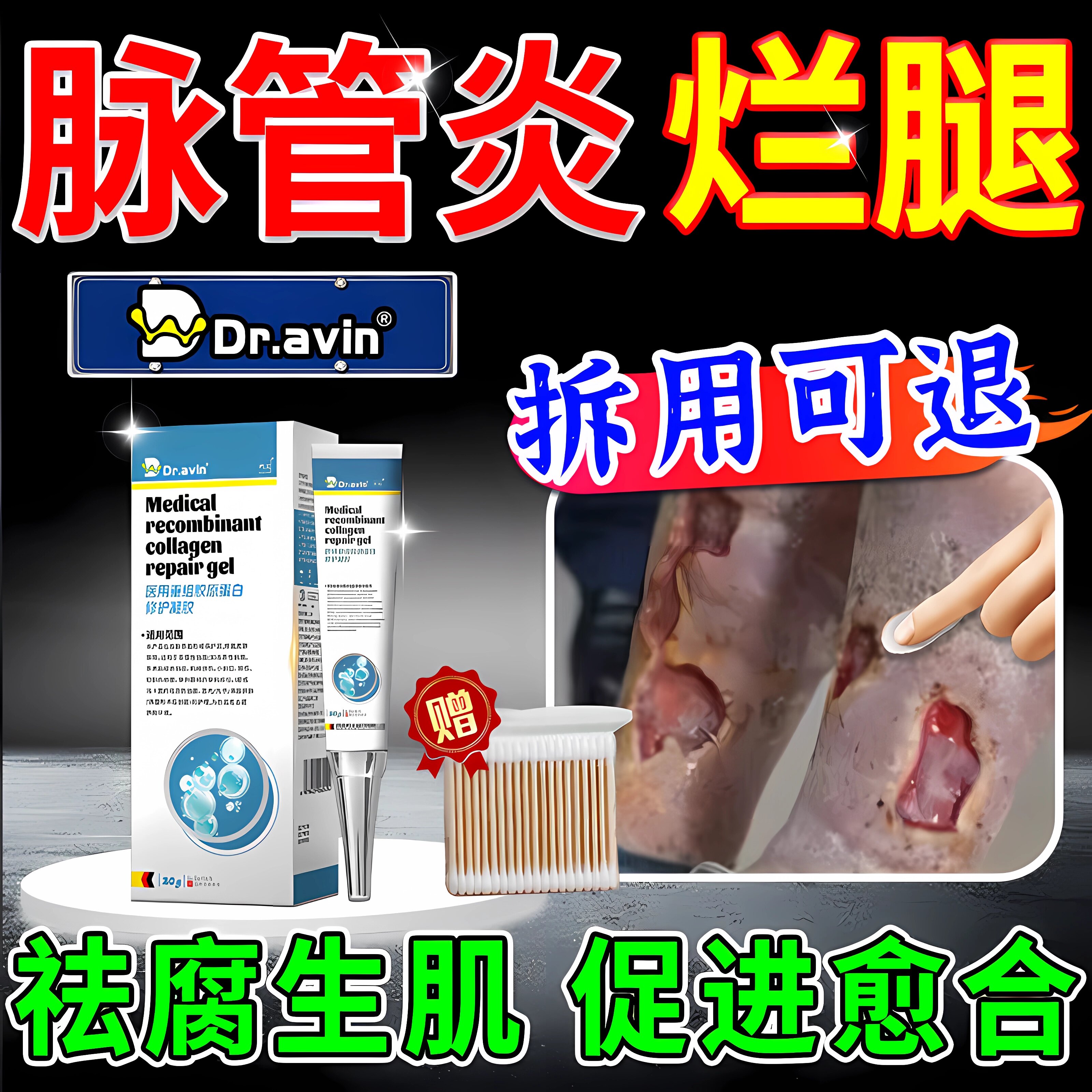 德国戴文脉管炎老烂腿专用去腐生肌膏下肢静脉溃烂发黑药房同售ZR