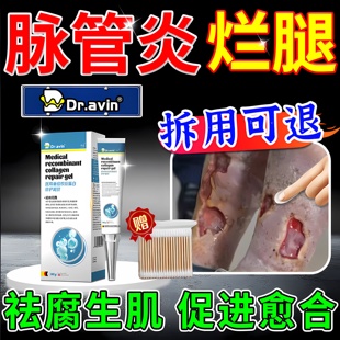 德国戴文脉管炎老烂腿专用去腐生肌膏下肢静脉溃烂发黑药房同售ZR