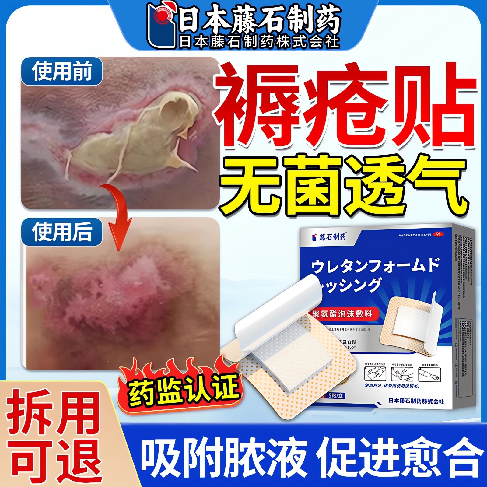 【拆用可退】褥疮贴老人臀部外用