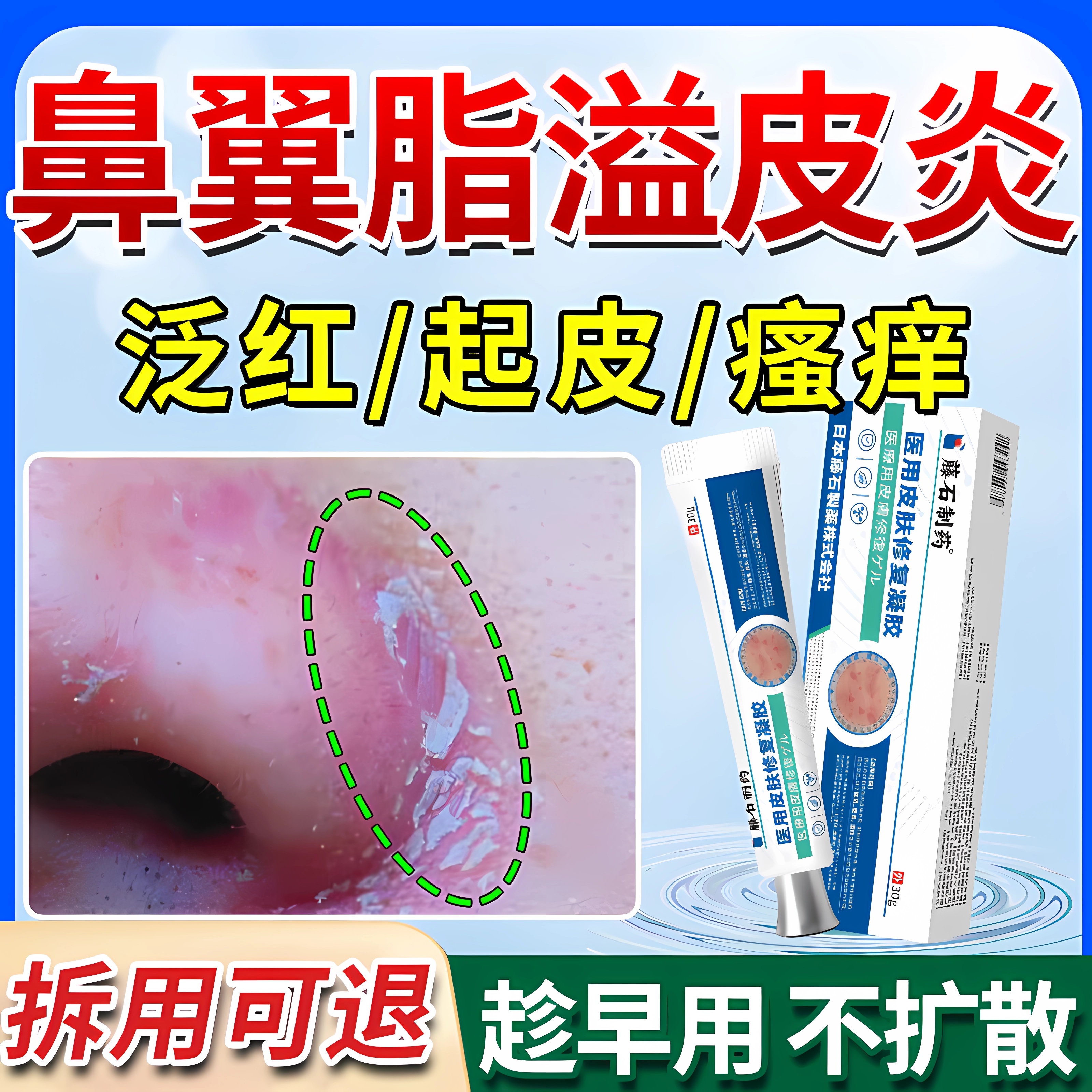 【藤石制药】鼻翼脂溢皮炎修复膏