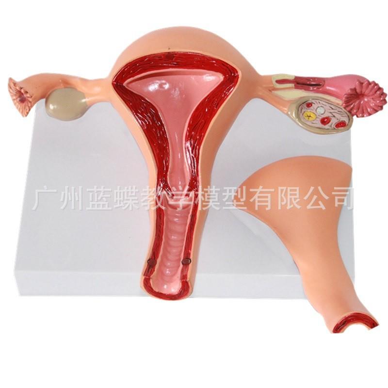 人体模型女性生殖子宫模型阴道卵巢模型教学模具病理变化科学教具
