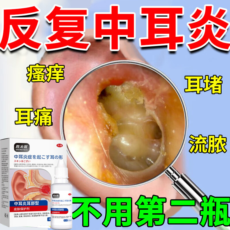 头孢特仑新戊酯巴妥新戊脂片片