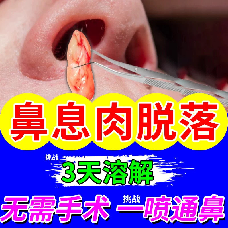 复方辛夷滴鼻液改善鼻炎鼻塞打喷嚏流鼻涕祛风宣肺清热解毒鼻痒,畜牧/养殖物资,动物保健品,淘宝优惠券,粉丝福利购,淘宝优惠卷