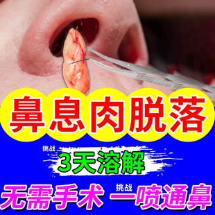 复方辛夷滴鼻液改善鼻炎鼻塞打喷嚏流鼻涕祛风宣肺清热解毒鼻痒