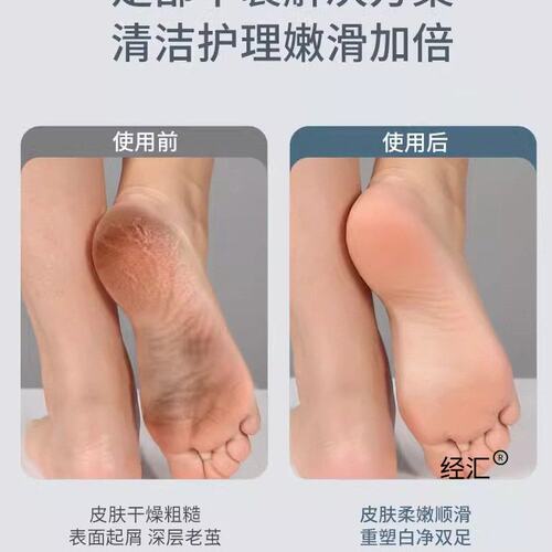 电动磨脚器脚后跟搓脚打磨机去脚皮死皮老茧修足神器脚跟去茧硬皮