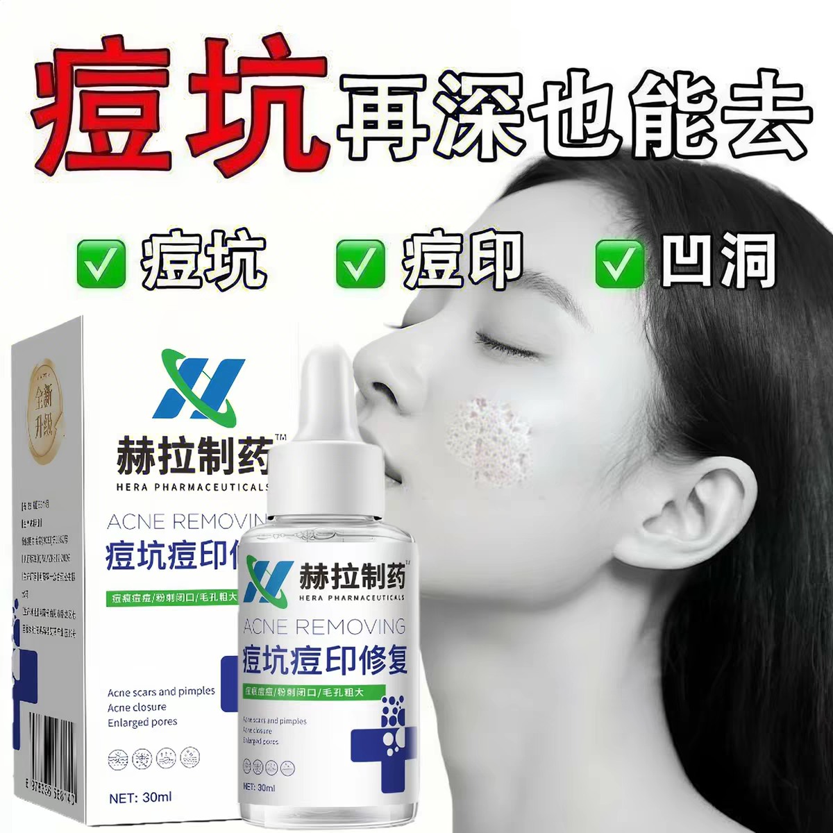【首尔生物精华】快速修复 闭口痘坑粉刺痘印毛孔粗大 买5送5