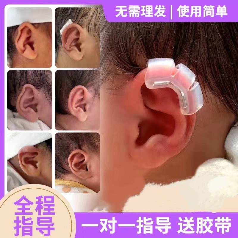 现货速发婴儿耳廓矫正器宝宝耳朵定型贴垂耳耳夹塑形新生儿硅胶带