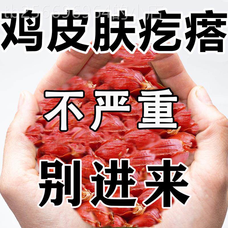 速发去鸡皮肤疙瘩囊毛部化药膏脸角腿上胳膊上小疙瘩毛囊炎专用身