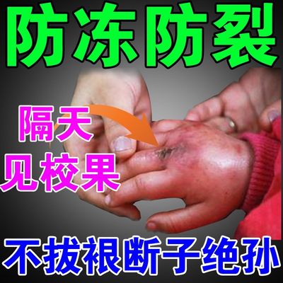 网红冻疮膏止痒冻伤膏消中防冻裂治儿童手足耳朵根冻伤开裂修复膏