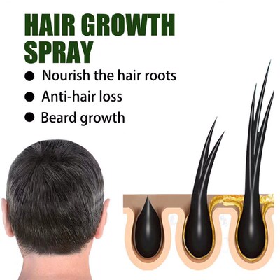 Hair growth spray nourishes hair roots, protects hair 50ml