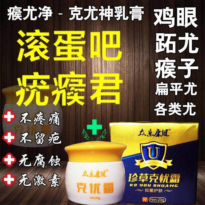极速巴蜀郎中祛疣止尤灵克尤液扁平手足尤瘊子.颈部丝状尤
